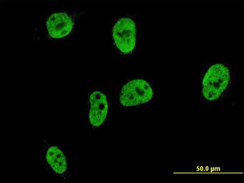 CDX1 monoclonal antibody (M03), clone 3A3