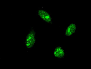 CDX1 monoclonal antibody (M02), clone 1F12