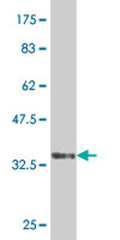 CDX1 monoclonal antibody (M02), clone 1F12