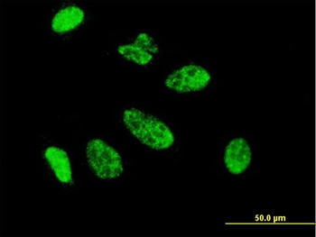 CDX1 monoclonal antibody (M01), clone 2D8