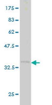 CDX1 monoclonal antibody (M01), clone 2D8