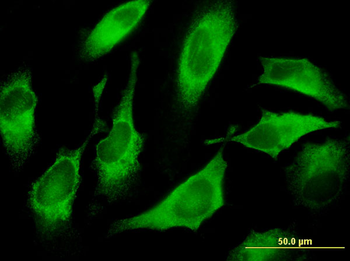 CDS1 monoclonal antibody (M01), clone 2D10