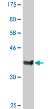 CDS1 monoclonal antibody (M01), clone 2D10
