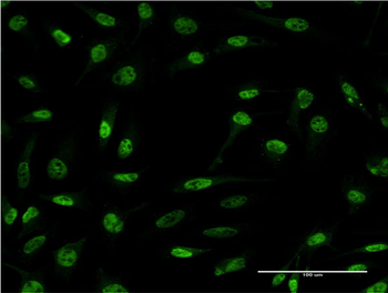CDR2 monoclonal antibody (M03), clone 4D2