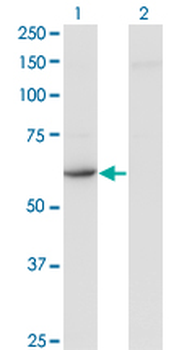 CDR2 monoclonal antibody (M03), clone 4D2