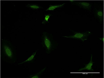 CDR2 monoclonal antibody (M02), clone 1F8