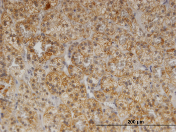 CDR2 monoclonal antibody (M02), clone 1F8
