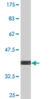 CDR2 monoclonal antibody (M02), clone 1F8
