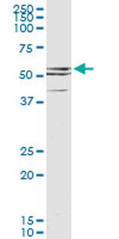 CDR2 monoclonal antibody (M01), clone 4F5