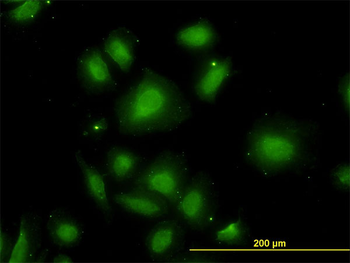 CDR2 monoclonal antibody (M01), clone 4F5