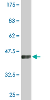 CDKN2D monoclonal antibody (M08), clone 2E10