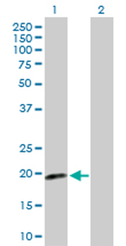 CDKN2D purified MaxPab rabbit polyclonal antibody (D01P)