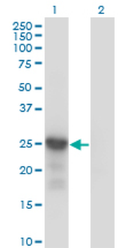 CDKN1B monoclonal antibody (M01), clone 4B4-E6