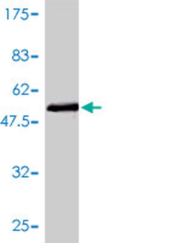 CDKN1B monoclonal antibody (M01), clone 4B4-E6