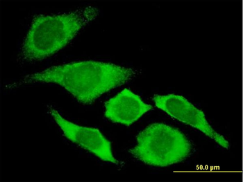 CDKN1A monoclonal antibody (M02), clone 2F1