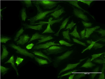 CDK9 monoclonal antibody (M07), clone 2D7