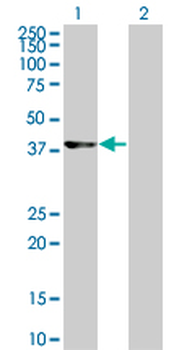 CDK9 monoclonal antibody (M07), clone 2D7