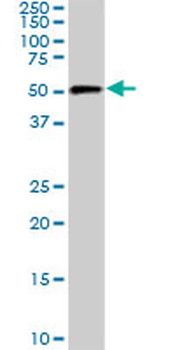 CDK8 monoclonal antibody (M04), clone 2E6