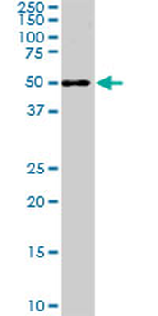 CDK8 monoclonal antibody (M04), clone 2E6