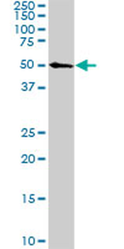 CDK8 monoclonal antibody (M04), clone 2E6