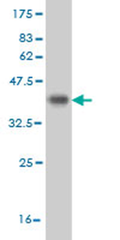 CDK8 monoclonal antibody (M04), clone 2E6