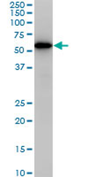 CDK8 monoclonal antibody (M02), clone 6E5