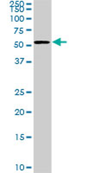 CDK8 monoclonal antibody (M02), clone 6E5
