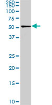 CDK8 monoclonal antibody (M02), clone 6E5