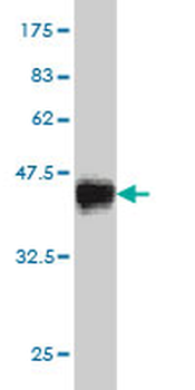 CDK8 monoclonal antibody (M02), clone 6E5