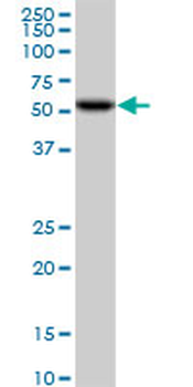 CDK8 monoclonal antibody (M01), clone 6H5