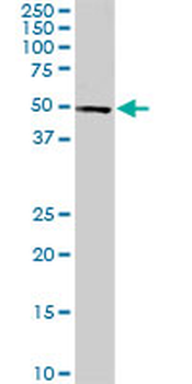 CDK8 monoclonal antibody (M01), clone 6H5