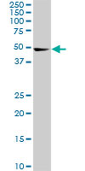 CDK8 monoclonal antibody (M01), clone 6H5