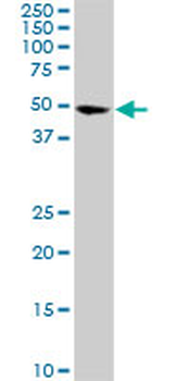 CDK8 monoclonal antibody (M01), clone 6H5
