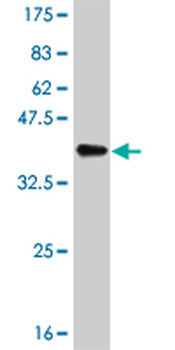 CDK8 monoclonal antibody (M01), clone 6H5