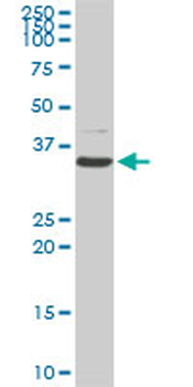 CDK4 monoclonal antibody (M07), clone 8C3