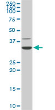 CDK4 monoclonal antibody (M07), clone 8C3
