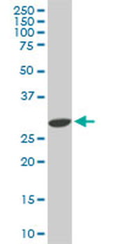 CDK4 monoclonal antibody (M05), clone 2A1