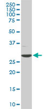CDK4 monoclonal antibody (M05), clone 2A1