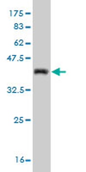 CDK4 monoclonal antibody (M05), clone 2A1