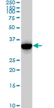 CDK2 monoclonal antibody (M02), clone 2E8