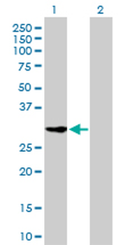 CDK2 monoclonal antibody (M02), clone 2E8