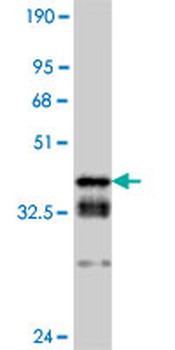 CDK2 monoclonal antibody (M02), clone 2E8