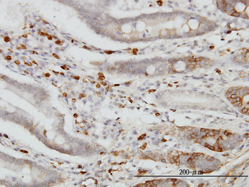 CDH18 monoclonal antibody (M01), clone 6F7