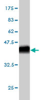 CDH18 monoclonal antibody (M01), clone 6F7