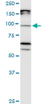 CDH11 monoclonal antibody (M05), clone 3C8