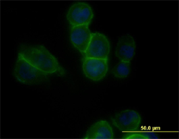 CDH11 monoclonal antibody (M05), clone 3C8
