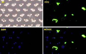 CDH11 monoclonal antibody (M05), clone 3C8