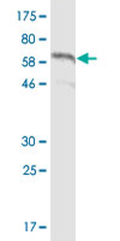 CDH11 monoclonal antibody (M05), clone 3C8