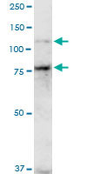 CDH11 monoclonal antibody (M04), clone 1A5