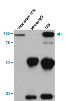CDH11 monoclonal antibody (M04), clone 1A5